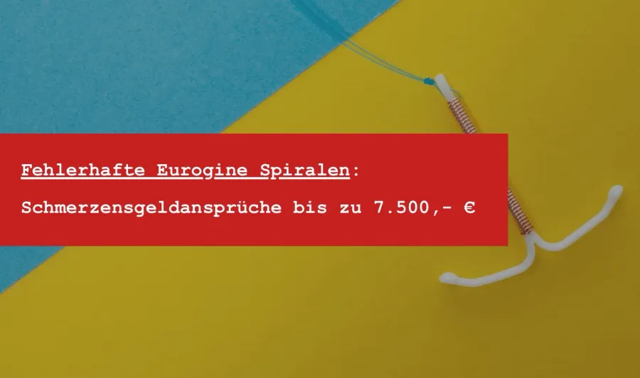 Produktfehler Eurogine Spirale: Schmerzensgeld nach Nova T Spirale Rückruf